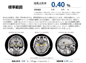 AI解析結果レポートのイメージ